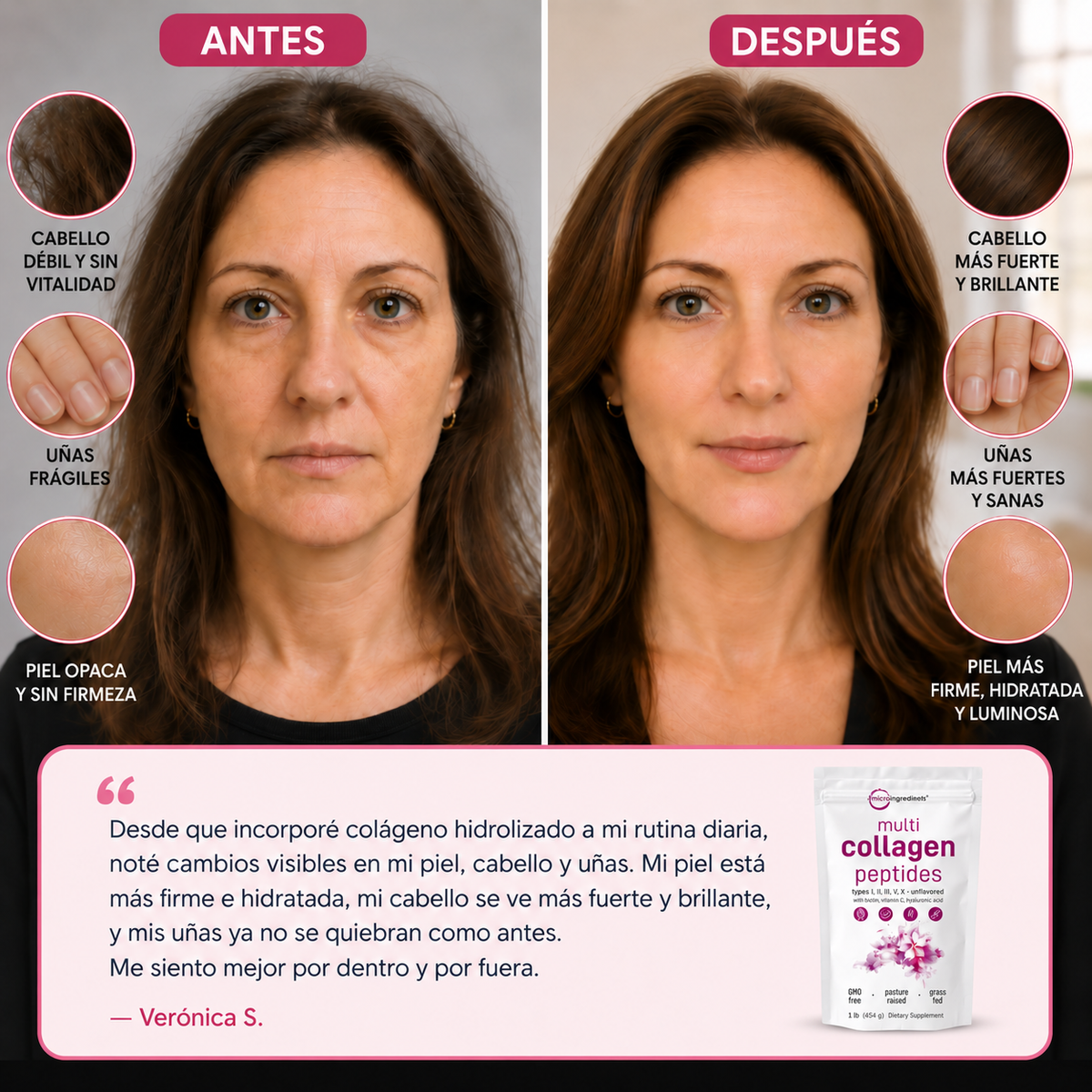 5 tipos de colágeno Belleza desde dentro💗
